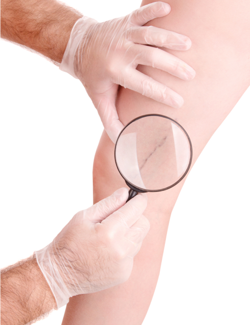 servicios de angiologia